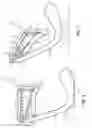 Fig. 06 - Seed firmer