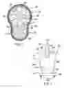 Fig. 03 - Mulching Assembly