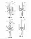 Fig. 09 - Auger support stand