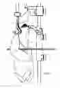 Fig. 11 - Device and method for removing abdominal fat from abdominal skin of a slaughtered bird suspended by the legs