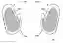 Fig. 01 - Glove game and method of use