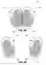 Fig. 03 - Glove game and method of use