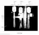 Fig. 10 - Applicators Including Non-Compliant Backer Members