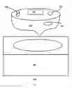 Fig. 02 - Precision applicator