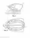 Fig. 02 - Motorized scrubbing, buffing, and polishing tool