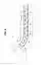 Fig. 05 - ENDOSCOPE INSERTION PORTION AND ENDOSCOPE