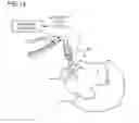 Fig. 15 - Airway adaptor and respiratory flow rate sensor