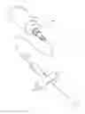 Fig. 01 - Five-bevel cannula for blood acquisition devices