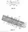 Fig. 06 - HIGH VISIBILITY ENDOPROSTHESIS AND METHOD