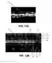 Fig. 07 - HIGH VISIBILITY ENDOPROSTHESIS AND METHOD