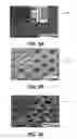 Fig. 03 - CATHETER BALLOON METHODS AND APPARATUS EMPLOYING SENSING ELEMENTS
