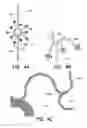 Fig. 05 - CATHETER BALLOON METHODS AND APPARATUS EMPLOYING SENSING ELEMENTS