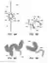 Fig. 10 - CATHETER BALLOON METHODS AND APPARATUS EMPLOYING SENSING ELEMENTS