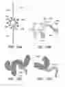 Fig. 11 - CATHETER BALLOON METHODS AND APPARATUS EMPLOYING SENSING ELEMENTS