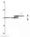 Fig. 28 - CATHETER BALLOON METHODS AND APPARATUS EMPLOYING SENSING ELEMENTS