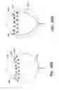 Fig. 60 - CATHETER BALLOON METHODS AND APPARATUS EMPLOYING SENSING ELEMENTS