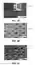 Fig. 03 - CATHETER BALLOON METHODS AND APPARATUS EMPLOYING SENSING ELEMENTS