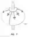 Fig. 08 - CATHETER BALLOON METHODS AND APPARATUS EMPLOYING SENSING ELEMENTS