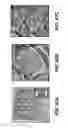 Fig. 63 - CATHETER BALLOON METHODS AND APPARATUS EMPLOYING SENSING ELEMENTS