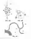 Fig. 05 - CATHETER BALLOON METHODS AND APPARATUS EMPLOYING SENSING ELEMENTS