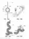 Fig. 12 - CATHETER BALLOON METHODS AND APPARATUS EMPLOYING SENSING ELEMENTS