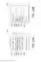 Fig. 25 - CATHETER BALLOON METHODS AND APPARATUS EMPLOYING SENSING ELEMENTS