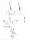 Fig. 48 - CATHETER BALLOON METHODS AND APPARATUS EMPLOYING SENSING ELEMENTS