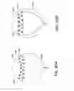 Fig. 60 - CATHETER BALLOON METHODS AND APPARATUS EMPLOYING SENSING ELEMENTS