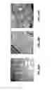 Fig. 64 - CATHETER BALLOON METHODS AND APPARATUS EMPLOYING SENSING ELEMENTS
