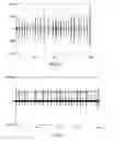 Fig. 05 - Devices, systems, and methods for determining heart rate of a subject from noisy electrocardiogram data