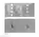 Fig. 04 - NON-IMAGING LOW FREQUENCY ULTRASONIC TESTING AND DIAGNOSTIC EVALUATION SYSTEM
