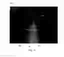 Fig. 12 - METHOD AND SYSTEM FOR ENHANCED VISUALIZATION AND SELECTION OF A REPRESENTATIVE ULTRASOUND IMAGE BY AUTOMATICALLY DETECTING B LINES AND SCORING IMAGES OF AN ULTRASOUND SCAN