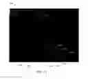 Fig. 13 - METHOD AND SYSTEM FOR ENHANCED VISUALIZATION AND SELECTION OF A REPRESENTATIVE ULTRASOUND IMAGE BY AUTOMATICALLY DETECTING B LINES AND SCORING IMAGES OF AN ULTRASOUND SCAN