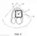 Fig. 05 - ULTRASONIC DIAGNOSTIC DEVICE