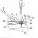 Fig. 01 - Surgical instrument for making incisions