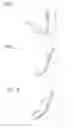 Fig. 02 - Surgical instrument for making incisions