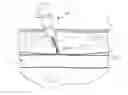 Fig. 01 - Vascular closure device