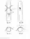 Fig. 03 - Vascular closure device