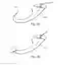 Fig. 04 - Vascular closure device