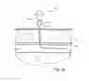 Fig. 06 - Vascular closure device