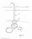 Fig. 02 - Vascular closure device