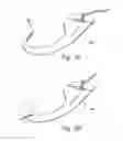 Fig. 04 - Vascular closure device