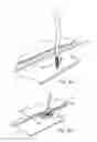 Fig. 05 - Vascular closure device