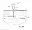 Fig. 06 - Vascular closure device