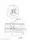 Fig. 08 - Vascular closure device