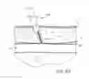 Fig. 10 - Vascular closure device