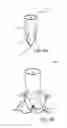 Fig. 12 - Vascular closure device