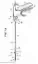 Fig. 02 - Devices and methods for cleaning a surgical device