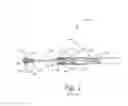 Fig. 02 - Endoscopic suture cinch