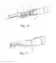 Fig. 09 - Endoscopic suture cinch